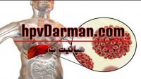 هپاتیت ب چیست | چه افرادی به آن مبتلا می شوند و چه علائمی دارد؟
