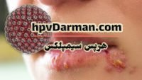 ویروس جنسی هرپس سیمپلکس ، علائم و عوارض آن چیست؟