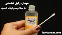 اسید سالیسیلیک چگونه زگیل تناسلی را درمان می کند؟