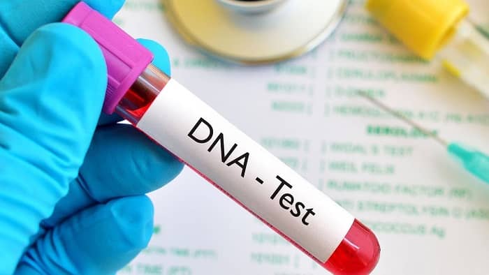 آزمایش dna برای تشخیص اچ پی وی مردان