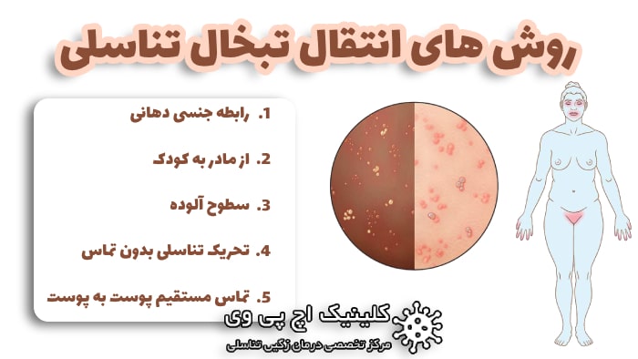 عکس روشهای انتقال ویروس تبخال تناسلی