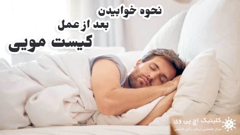 استحمام بعد از عمل کیست مویی