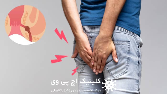 یبوست مزمن از علت های رایج عود فیستول