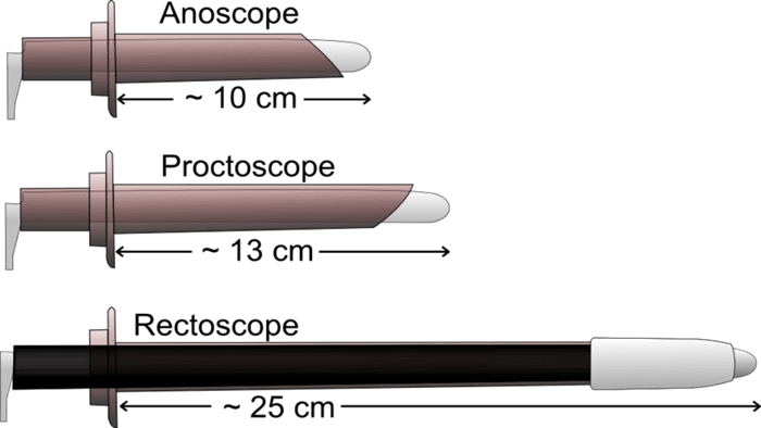 تفاوت آنوسکوپی با پروتوسکوپی