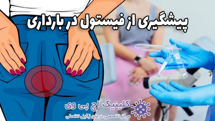 روشهای پیشگیری از فیستول در زمان حاملگی