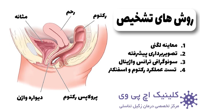 تصویر اینفوگرافیک از روش‌ های تشخیص رکتوسل