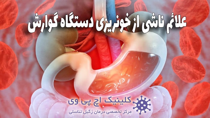 عکس علائم خونریزی دستگاه گوارش