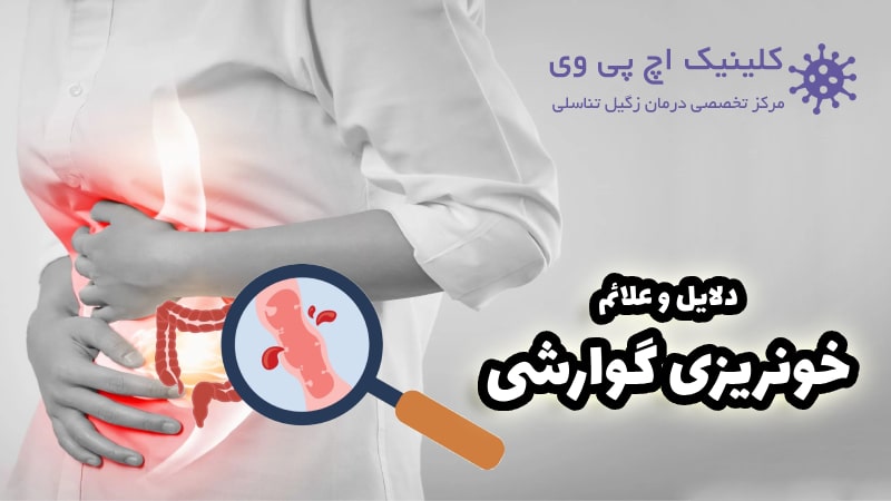 عکس خونریزی گوارشی