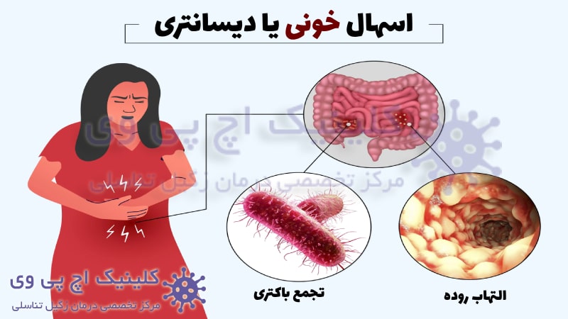 عکس اسهال خونی