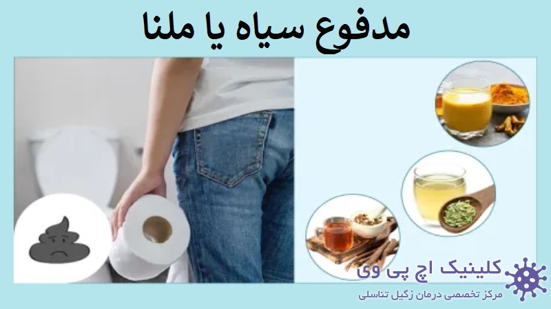 عکس ملنا یا مدفوع سیاه