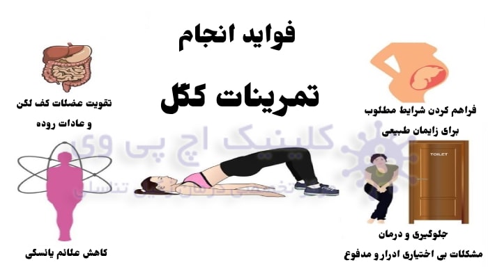فواید انجام ورزش کگل چیست