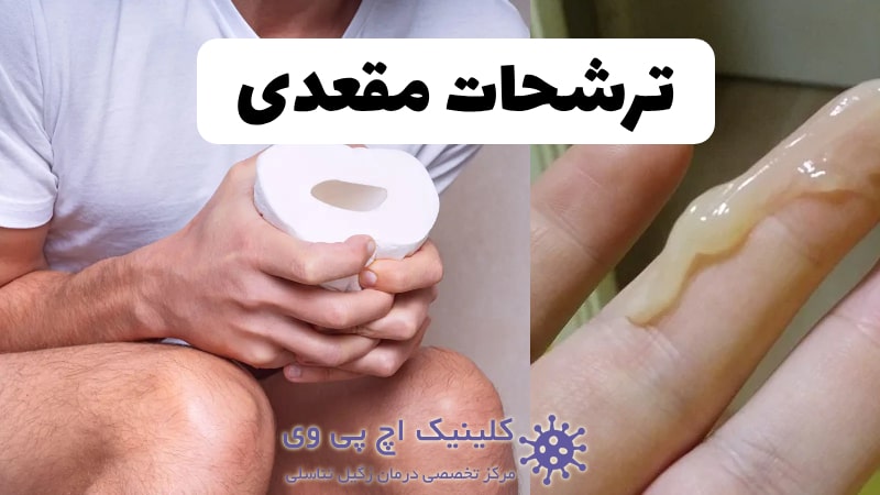 عکس ترشحات مقعدی