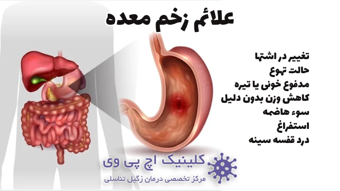 عکس از نشانه های زخم معده