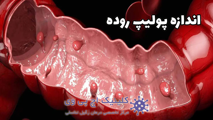 عکس اندازه پولیپ روده