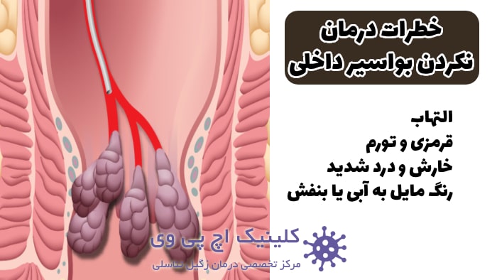 عکس خطرات درمان نکردن هموروئید داخلی 