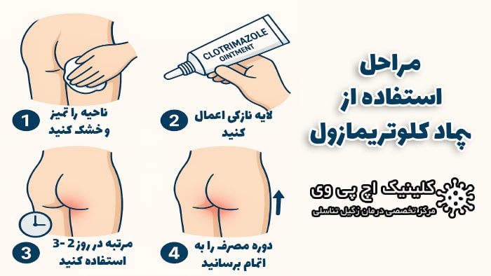 عکس مراحل استفاده از پماد کلوتریمازول